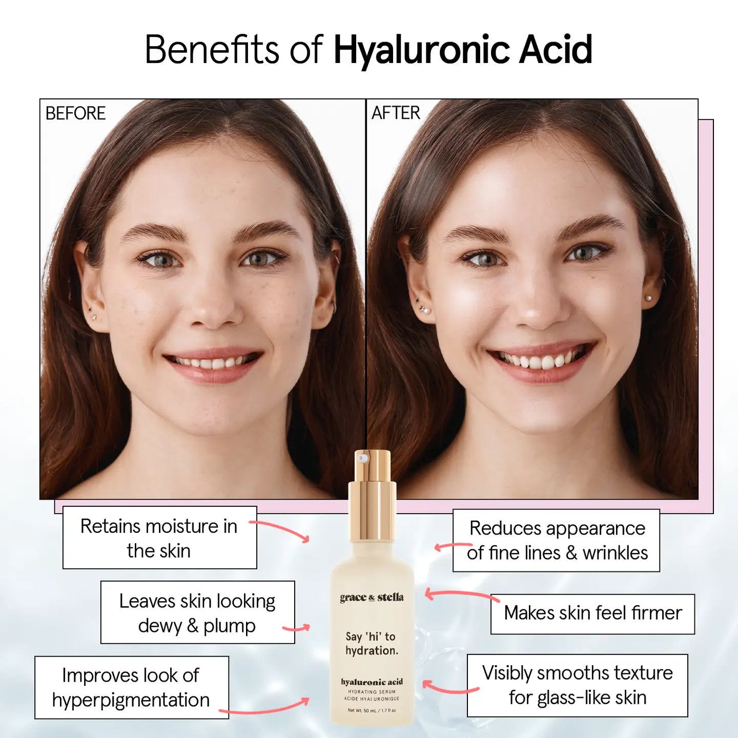 Grace & Stella Award Winning Hyaluronic Acid Serum (50ml/1.7 fl oz) Hyaluronic Acid Serum for Face - Acido Hialuronico Face Serum for Women - Hydrating Serum Remove Fine Lines, Wrinkles - Anti Aging